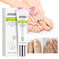 Compre 2 Leve 5 - Efero Nails - Gel Anti Fungos e Micoses + 2 Brindes