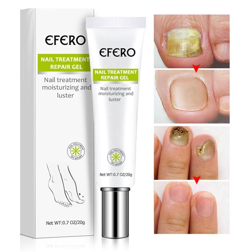 Compre 1 Leve 2 - Efero Nails® - Gel Anti Fungos e Micoses - Site Oficial De Vendas Efero Nails® - Gel Anti Fungos 001 Pandariaimports 