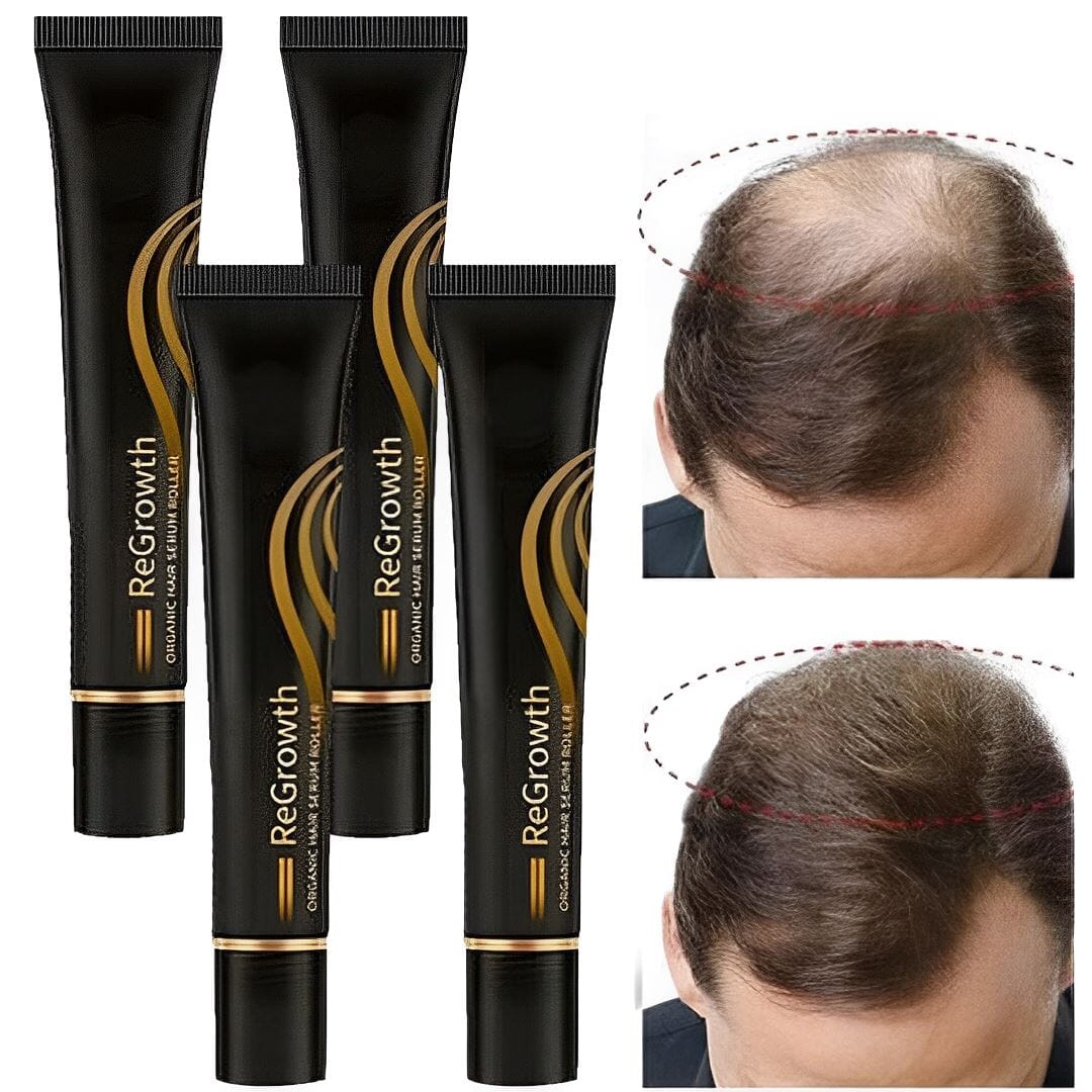 Compre 1 Leve 4 - Repair Hair Regrowth® Óleo de Crescimento Capilar + Brinde - Site Oficial De Vendas Repair Hair Regrowth 001 Pandariaimports 