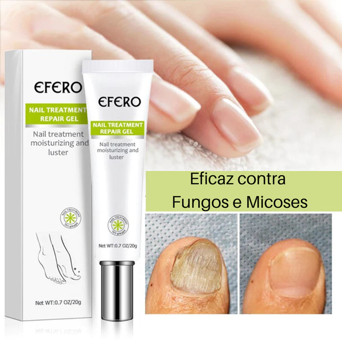 Efero Nails® - Gel Anti Fungos e Micoses - Site Oficial De Vendas 0 Pandariaimports 