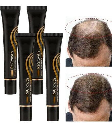 Repair Hair® Óleo de Crescimento Capilar + Brinde - Site Oficial De Vendas 0 Pandariaimports 