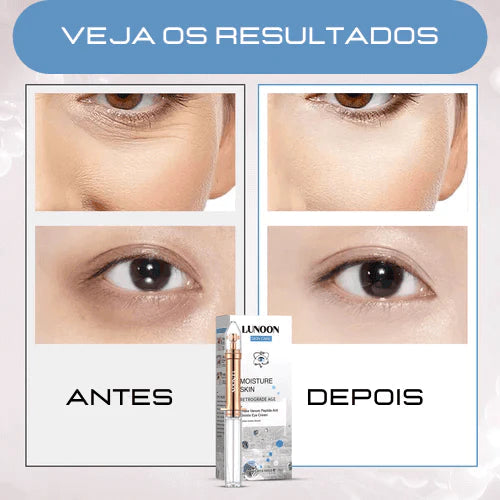 VisionSkin™ 3D - Revitaliza Os Olhos 6 Em 1 (COMPRE 3 LEVE 5) + Brinde - Site Oficial De Vendas VisionSkin™ 3D - Revitaliza Os Olhos 6 Em 1 001 Pandariaimports 